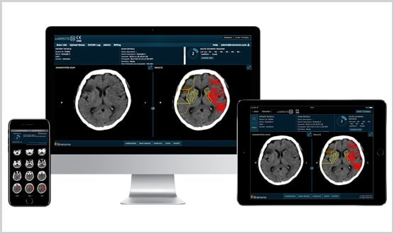 Northwick Park Hospital adopts new software to help identify stroke victims