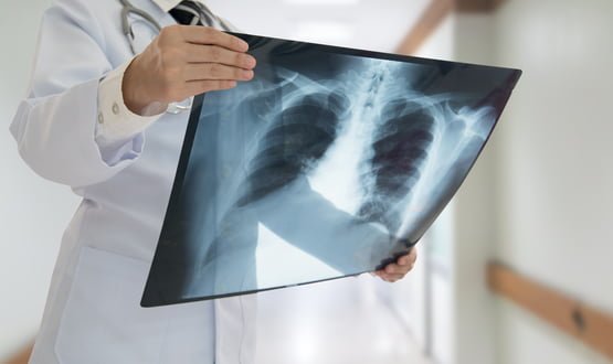 Artificial intelligence system could cut critical chest x-rays assessment time