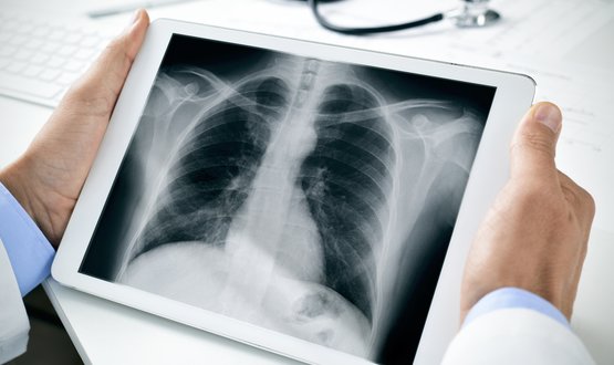 Image Exchange Portal to be extended to patients across in England