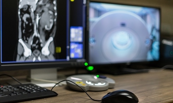 Royal Berkshire Hospital to deploy Brainomix AI for rapid stroke diagnosis