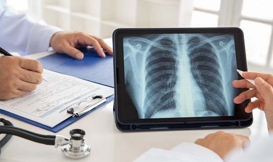 Radiology image sharing network launched across 7 trusts in Yorkshire
