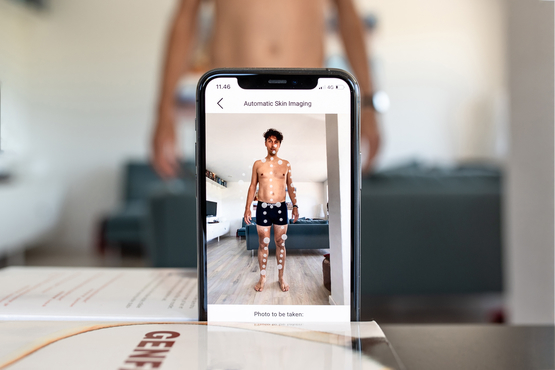 The company introduced automatic skin imaging that allows people to take full body photographs of their own skin to make skin cancer self-examinations
