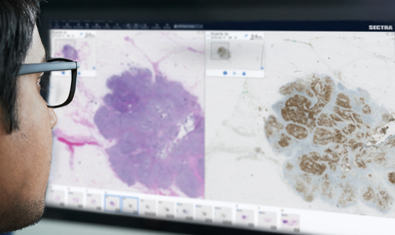 Barts Health signs deal with Sectra for digital pathology network